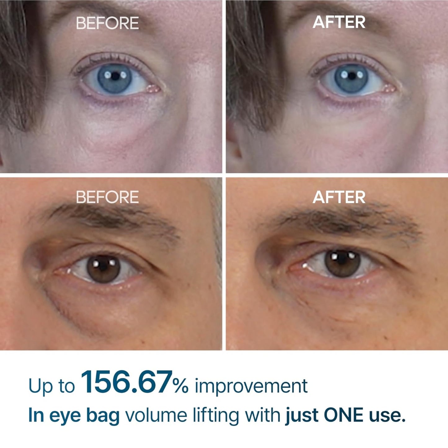 Glivori - Eyephalt Eyebag Cream