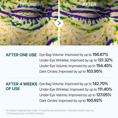 Glivori - Eyephalt Eyebag Cream